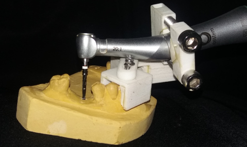 Prerna Karde - Device to guide Dental Implant Drill